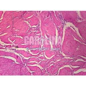  Human Pyloric Stomach, sec. Microscope Slide, 7 u 