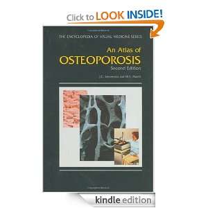 An Atlas of Osteoporosis, Second Edition (The Encyclopedia of Visual 