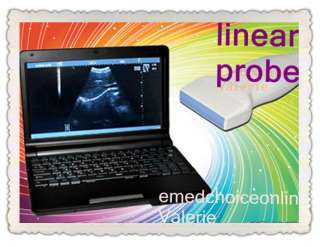 Full Digital Laptop Ultrasound Scanner Machine With Linear Probe 100% 