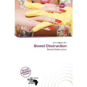  Bowel Obstruction (9786200594297) Jerold Angelus Books