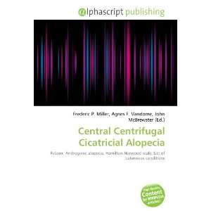    Central Centrifugal Cicatricial Alopecia (9786134033633) Books