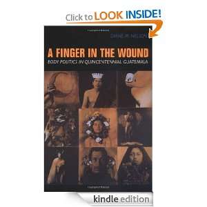 Finger in the Wound Body Politics in Quincentennial Guatemala 